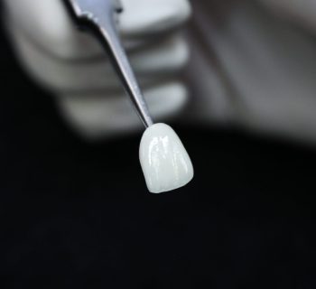 067_IMPLANTOLOGIA_RA-1-1920x1024